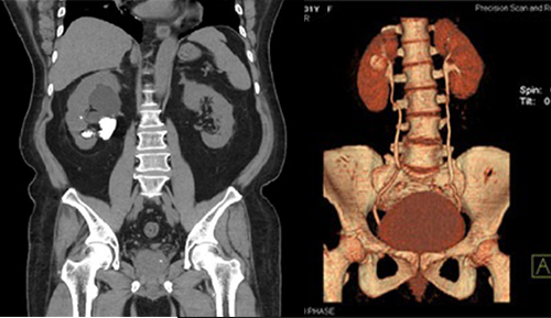 CT-Urogrpahy (1)