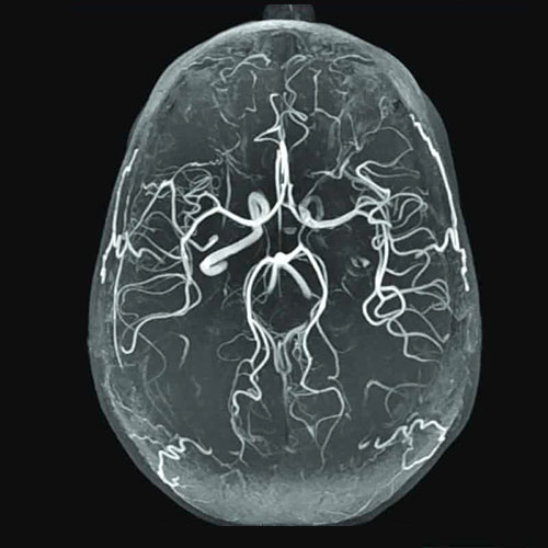 MRI-Angiography (1)