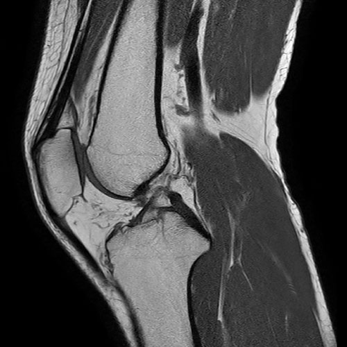 MRI-Musculoskeleton-system (1)